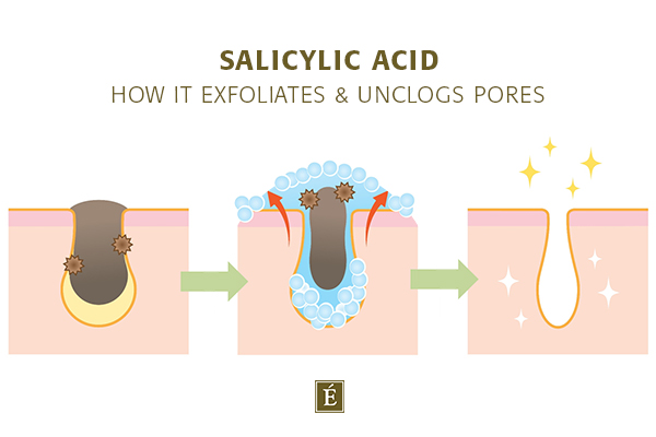 How To Get Rid Of Breakouts | how salicylic acid exfoliates and unclogs pores